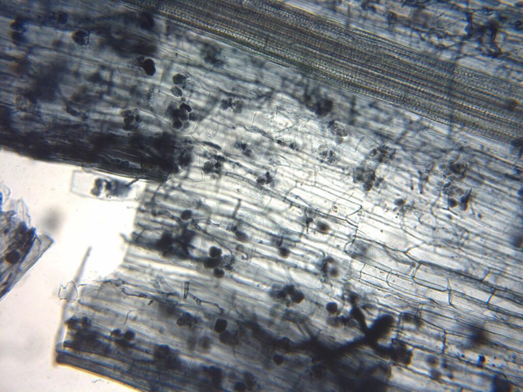 Nấm rễ cộng sinh mycorrhiza – Hấp thu lân, nước và sức khỏe rễ