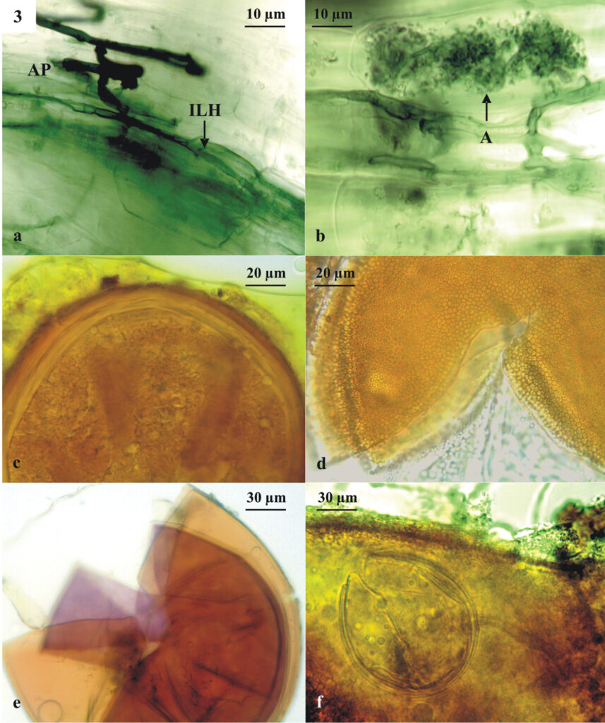 Nấm rễ cộng sinh mycorrhiza – Hấp thu lân, nước và sức khỏe rễ - anh minh hoa 2
