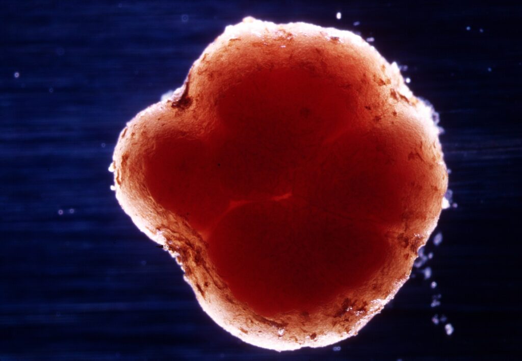 Rhizobium cố định đạm: hình thành nốt sần và điều kiện cộng sinh - real field image 1